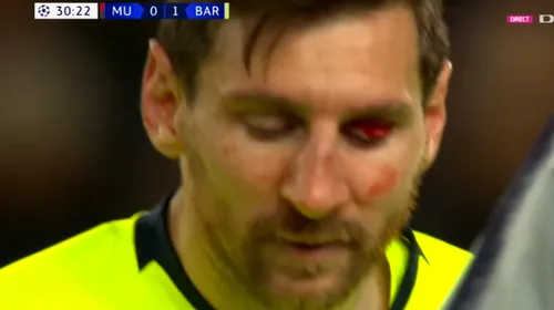 Imagini HORROR! Messi, plin de sânge în partida cu Manchester United: ce i s-a întâmplat vedetei Barcelonei