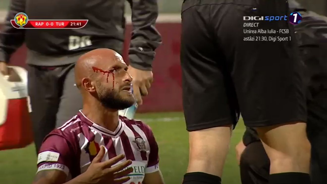 FOTO horror | Ionuț Voicu, plin de sânge în urma unui duel aerian 