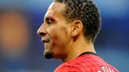 Declarație GENIALĂ‚ a lui Ferdinand, după ce un fan al lui City i-a spart capul cu o monedă:** "Era bine dacă măcar era una de o liră" :)