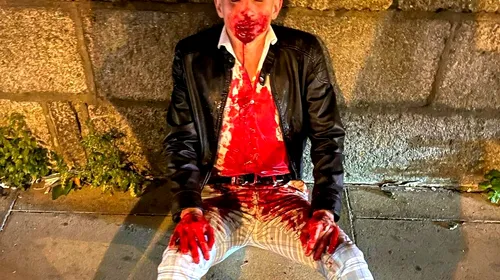 De la Jocurile Olimpice, direct la spital! Un luptător de taekwondo, desfigurat pe stradă și lăsat într-o baltă de sânge! Imagini șocante!