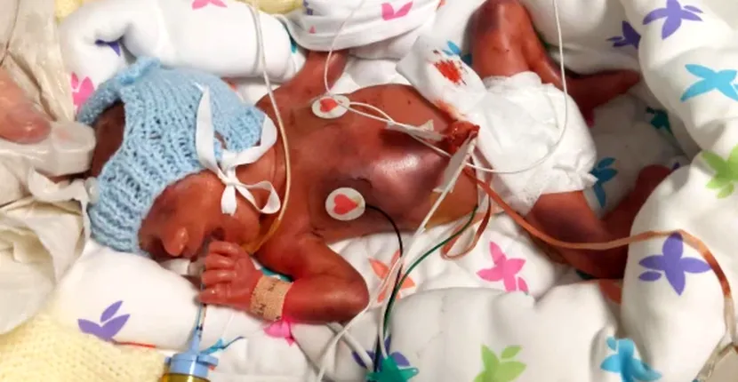 ”Fiul nostru a încetat să mai respire timp de 18 minute și a fost aproape de moarte”. Povestea nou-născutului care a petrecut 87 de zile în spital