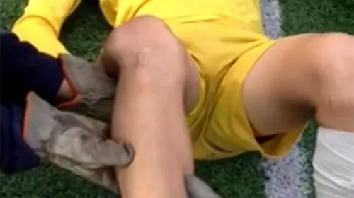 VIDEO ȘOCANT | Un fotbalist amator a suferit o accidentare teribilă: paramedicii i-au pus genunchiul la loc chiar pe teren