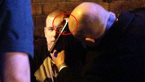 FOTO: Rugbyst atacat cu un ciocan în fața unui club