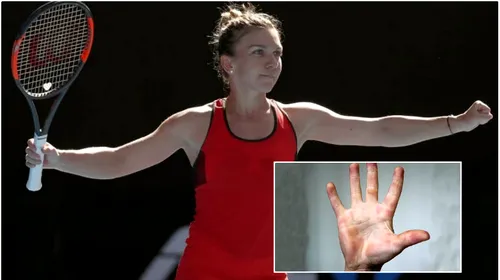 IMAGINEA ZILEI | Cum arată mâna Simonei Halep după un meci de tenis