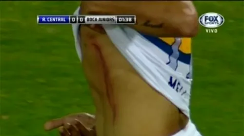 VIDEO | Violențe la meciul dintre Rosario și Boca Juniors. Doi jucători ai oaspeților au fost loviți cu obiecte și pietre aruncate din tribună