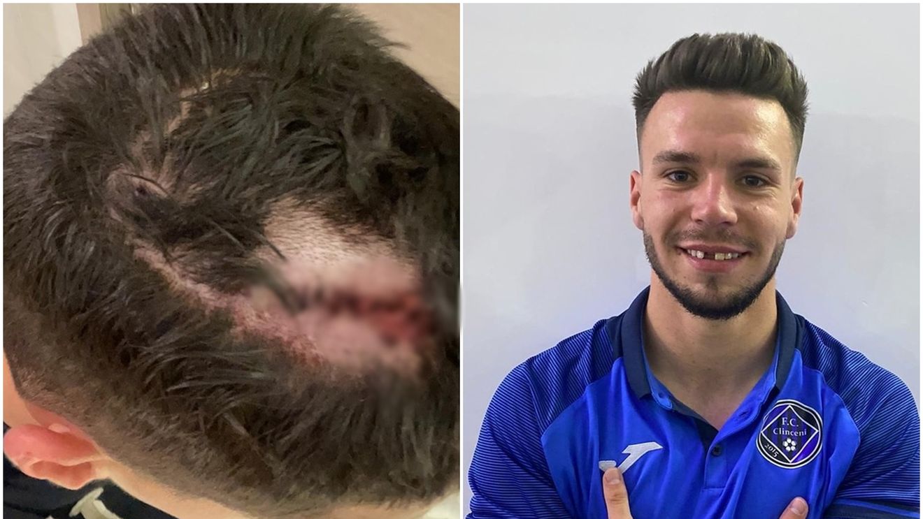 Academica Clinceni, etapa și victima! Octavian Vâlceanu și Andrei Cordea, accidentări horror în ultimele două meciuri: „Din ce știu eu, se sancționează cu cartonaș roșu!” | EXCLUSIV