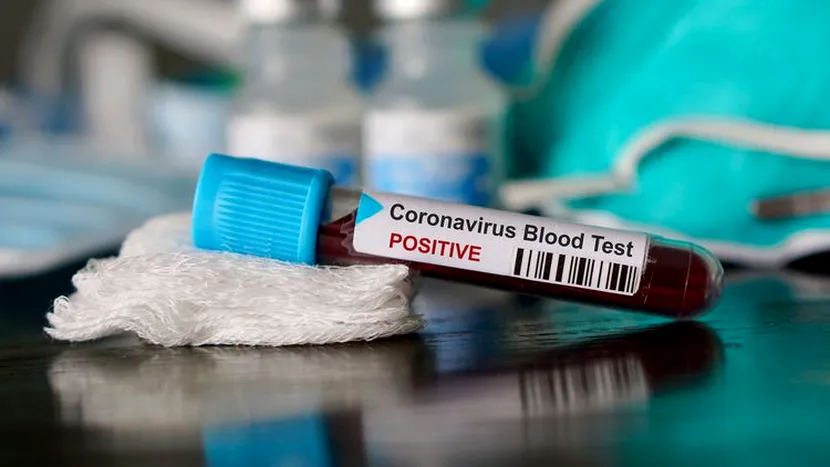 Numărul cazurilor confirmate de coronavirus a ajuns la 123 în România. Președintele Klaus Iohannis a anunțat că va decreta starea de urgență luni