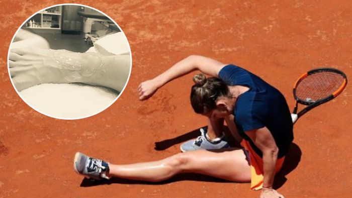 Vești îngrijorătoare de la Simona Halep: "Am ajuns devreme la Paris pentru tratament. Am ruptură de ligamente". Care sunt șansele date de medici pentru Roland Garros