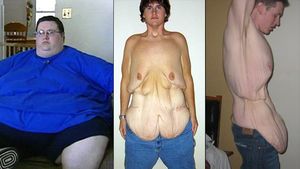 FOTO Omul cu voință de fier! Sportul l-a salvat! "Îmi mai dăduseră 4 luni de trăit" Transformare uluitoare