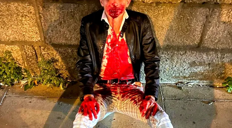 De la Jocurile Olimpice, direct la spital! Un luptător de taekwondo, desfigurat pe stradă și lăsat într-o baltă de sânge! Imagini șocante!