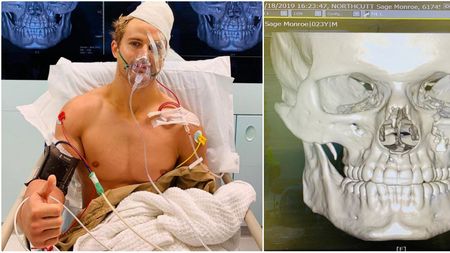 Meciul s-ar fi putut lăsa cu o tragedie! A fost făcut KO: craniul i-a fost fracturat în opt locuri, iar operația a durat nouă ore | VIDEO