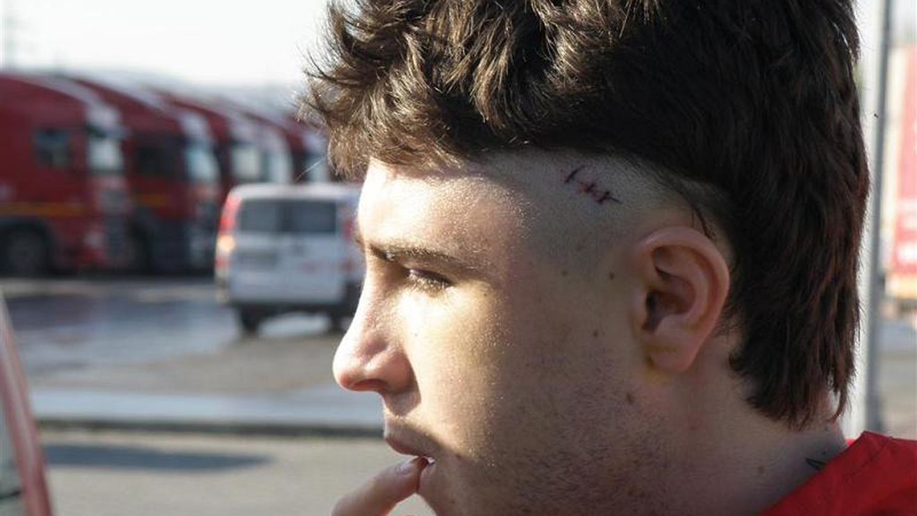 FOTO** Kosovo la Vaslui?! "Răduț a fost la 10 mm de moarte!"