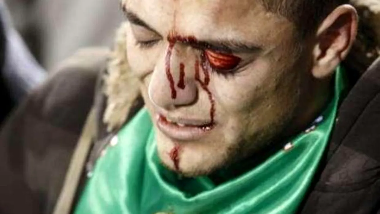 Fotbalul, la un pas de tragedie!** VIDEO&FOTO: Sute de răniți și scene de groază provocate de fani în Arabia