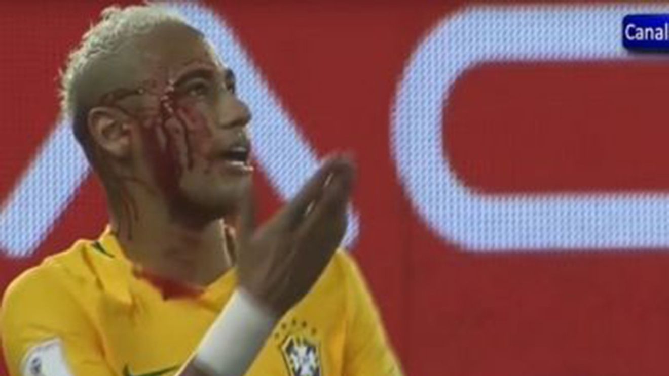 VIDEO | Neymar a încercat să-i treacă mingea printre picioare unui adversar și s-a ales cu arcada spartă