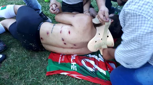 ȘOCANT! Incidente grave la un meci din Argentina. FOTO | Fotbaliștii, împușcați pe teren de forțele de ordine