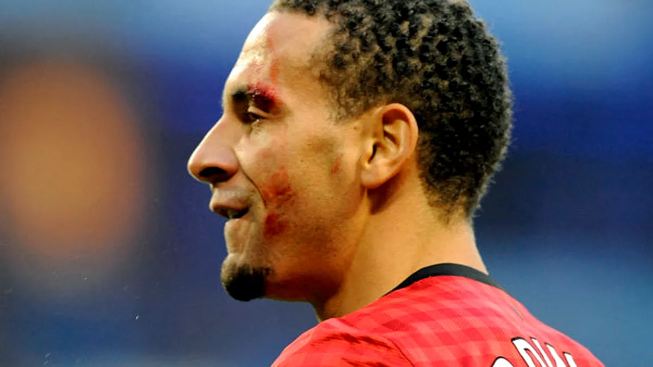 Declarație GENIALĂ‚ a lui Ferdinand, după ce un fan al lui City i-a spart capul cu o monedă:** 