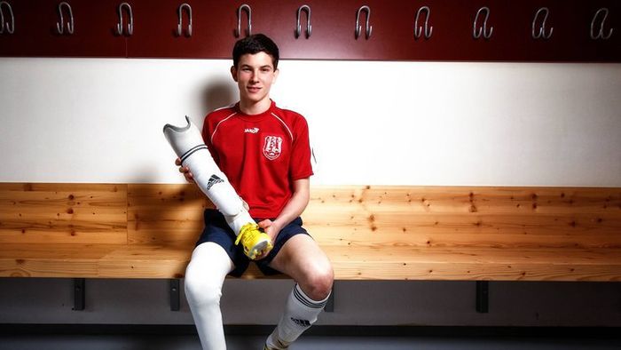 Lecția unui fotbalist de 22 de ani. Cum să lupți pentru ceea ce te face fericit. A fost primul jucător care a primit acceptul FIFA de a evolua cu proteză, dar cancerul l-a învins: "Fotbalul este cel mai frumos lucru de pe pământ"