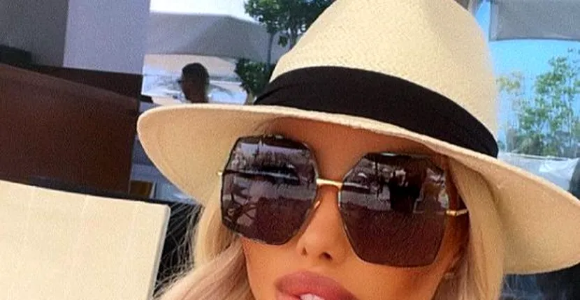 FOTO / Loredana Chivu nu a scăpat de problemele după injectarea feselor! E șocant cum a apărut la plajă