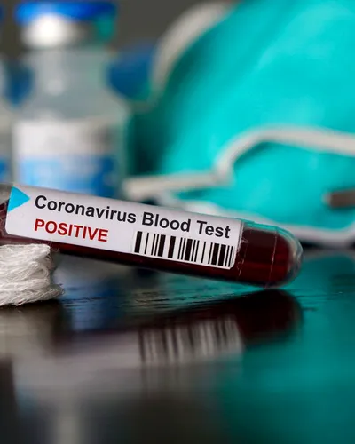 Un vaccin pentru coronavirus testat pe șoareci, rezultate încurajatoare!