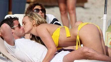 Fosta iubită a lui Matthew Bates a ajuns de nerecunoscut