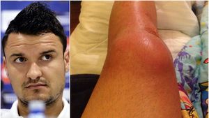Atenție, fotbaliști din Liga 1! Gazonul sintetic de la Chiajna face o nouă victimă: Budescu, infectat cu o bacterie care poate fi fatală VIDEO | Cazul grav petrecut luna aceasta în SUA