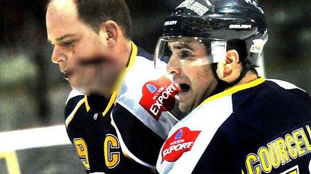 FOTO horror - Asta este cea mai groaznică accidentare din istoria sportului! Un hocheist s-a ales cu fața sfâșiată