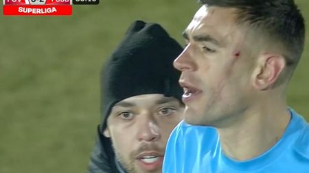 Eroare gravă de arbitraj în favoarea FCSB! Malcom Edjouma și-a desfigurat adversarul. „Un fault grosolan! Trebuia să dea cartonaș roșu!” Cum arată fundașul lui FC Voluntari | FOTO