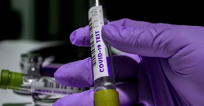 Alte 104 cazuri noi de coronavirus în ultimele 24 de ore în România