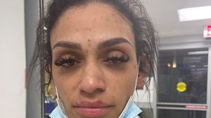Soția celebrului sportiv, mărturii cutremurătoare: „M-a abuzat în toate modurile! Copiii au fost martori!” .E șocant ce scrie pe raportul medico-legal: atac prin strangulare, comoție cerebrală, fractură nazală!