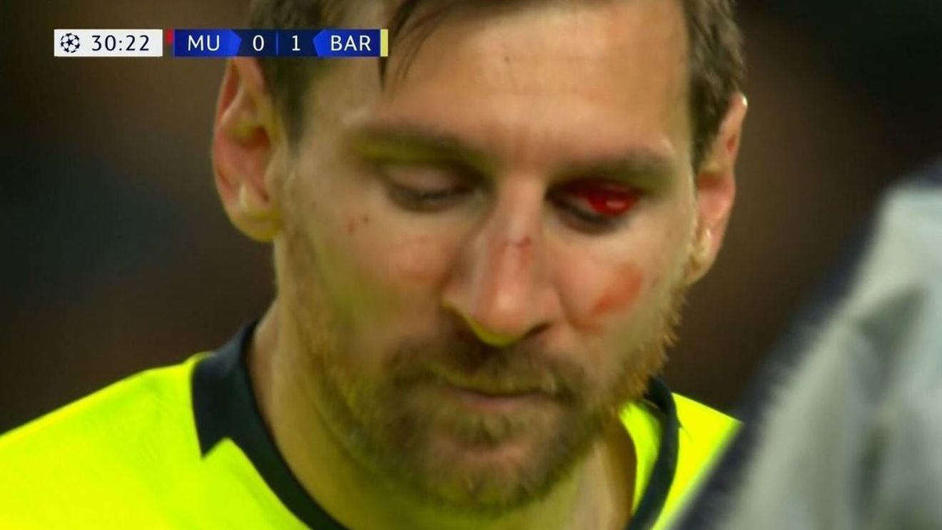 Messi, probleme serioase după ce Smalling l-a umplut de sânge