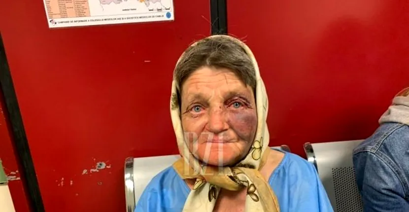 Bătrână snopită în bătaie de 3 tineri, în gara din Iași. Femeia a ajuns de urgență la spital, cu răni pe tot corpul! Maică, mă băteau şi râdeau