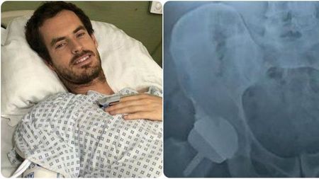 Andy Murray, operat la Londra: "Acum am un șold metalic" | FOTO