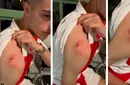 Poliția din Germania a dat-o în urmărire pe femeia care l-a mușcat pe un fan! Totul s-a petrecut în timpul unei bătăi de la EURO când atacantul și-a aruncat tricoul în tribună!