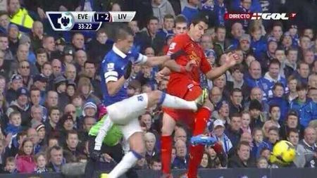 VIDEO Intrare criminală asupra lui Suarez! FOTO: Vedeta lui Liverpool a rămas cu o "gaură" în picior