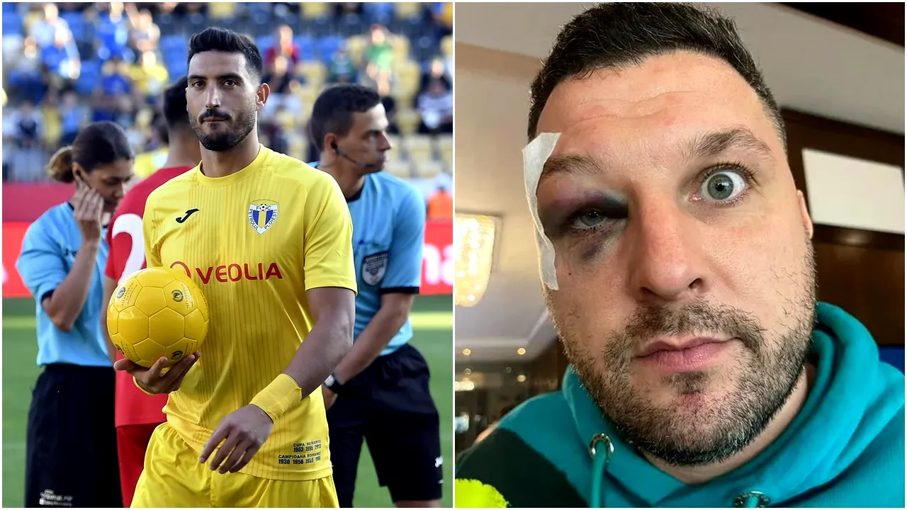 Younes Hamza, atacantul care a făcut senzație la Petrolul Ploiești și a refuzat transferul la echipa lui Gigi Becali, e implicat într-un scandal de proporții! L-ar fi rupt cu bătaia pe un partener de afaceri: „Mi-a spart arcada, mi-a spart tot”