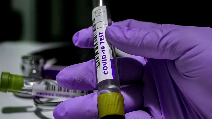 Alte 104 cazuri noi de coronavirus în ultimele 24 de ore în România