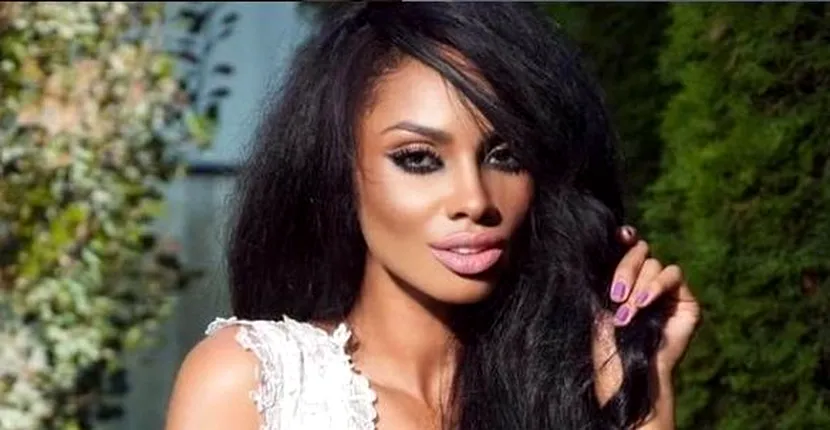 FOTO. Imagini șocante cu Laurette după ce a fost bătută în camera de hotel. Cu ce răni s-a ales