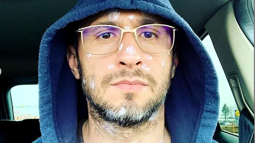 Dragoș Bucur a făcut varicelă la 42 de ani. A fost în carantină cu fiul lui