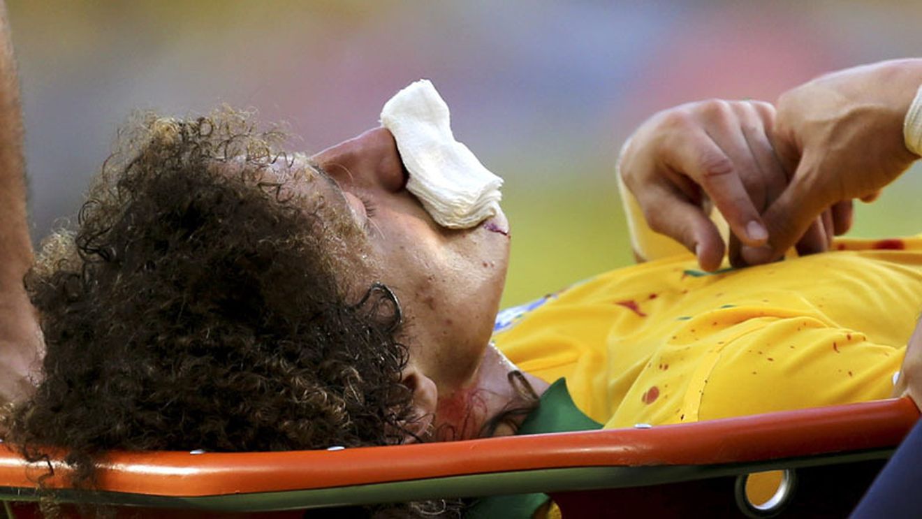 David Luiz s-a accidentat după o ciocnire cu Thiago Silva și va fi operat