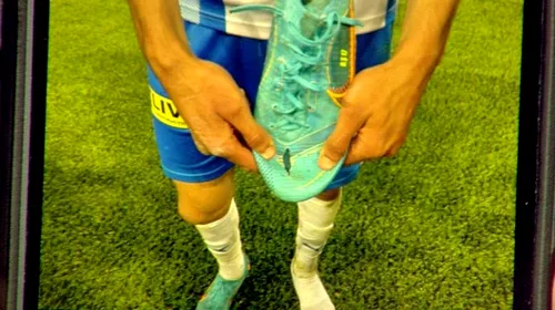 Gabriel Tamaș l-a „măcelărit” pe Ștefan Baiaram în Universitatea Craiova – FC Voluntari! Cum arată piciorul olteanului | VIDEO