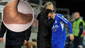 FOTO | Glezna lui Hora arată horror la patru zile după intervenția lui Stăncioiu. "Ne e frică să nu aibă ligamentele afectate"
