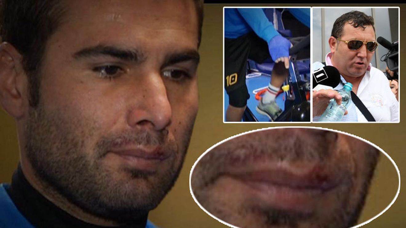 Falimentul experimentului Mutu: adus la Petrolul pentru 25.000 â‚¬ pe lună, atacantul a fost rănit în urma conflictului cu un personaj controversat. "Și-a prins degetul în ușa de la mașină, a fost la spital"