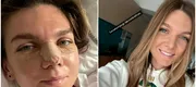 Doctorul care i-a făcut operația estetică Simonei Halep explică pe înțelesul tuturor procedeul: „Nasul operat trebuie să-și păstreze unicitatea!” FOTO