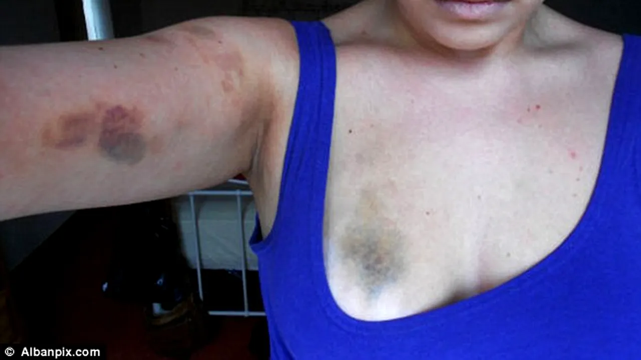 Cum a scăpat un instructor de fitness nepedepsit, după ce și-a bătut măr iubita. FOTO